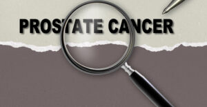 New Prostate Cancer Drug Approved for NHS England