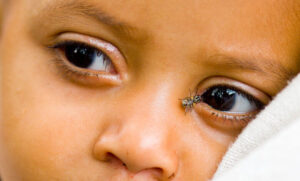 Fiji Becomes 26th Country to Eliminate Trachoma as Public Health Threat