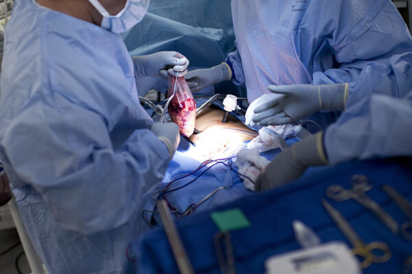 Record Survival After Pig Kidney Transplant Marks Major Milestone