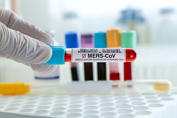 WHO adds MERS-CoV isolate to its BioHub System to enable rapid, transparent sharing of biological materials for pandemic research.