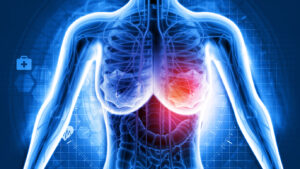 Low-Dose Hot Flash Treatment Shows Promise in Slowing ER-Positive Breast Cancer Growth
