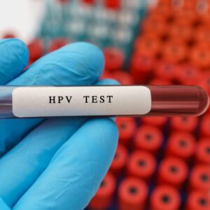 Menstrual Blood Test Shows Promise as Easier HPV Screening Method