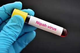 WHO Confirms Nipah Virus Case in Bangladesh Amid Regional Spread