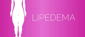 Medical Breakthrough: Lipedema Officially Recognized as a Chronic Disease