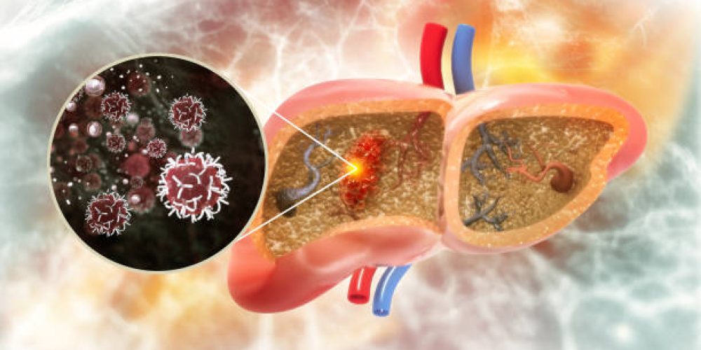 New Genetic Pathway Linked to Liver Congestion and Cancer