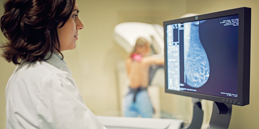 AI Integration in Breast Cancer Screening Reduces Interval Cancer Rates by 12 Percent