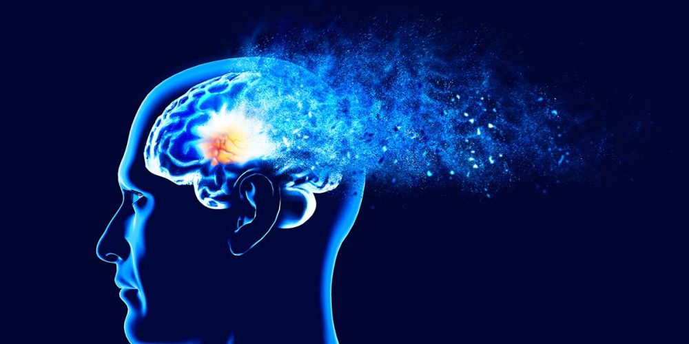 Alzheimer’s Far More Widespread Than Estimated, New Research Warns of Growing Global Impact