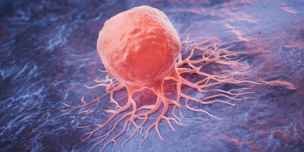 Cancer Treatment Disparities Grow in England as Local Funding Caps Limit New Drugs