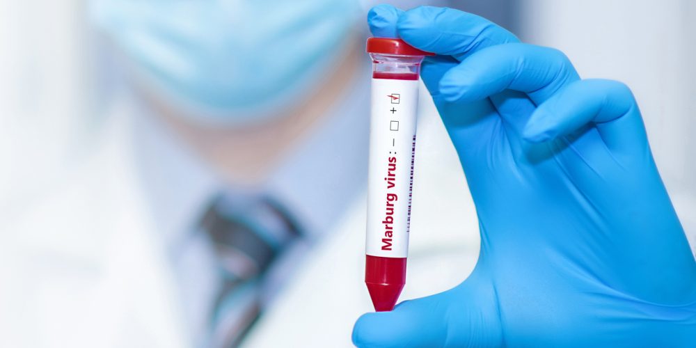 Ethiopia Confirms Rising Marburg Death Toll as Officials Race to Contain Outbreak