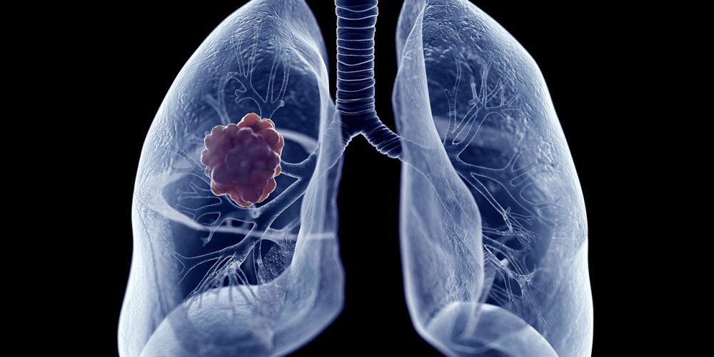 Former England Cricketer Raises Awareness After Shock Lung Cancer Diagnosis