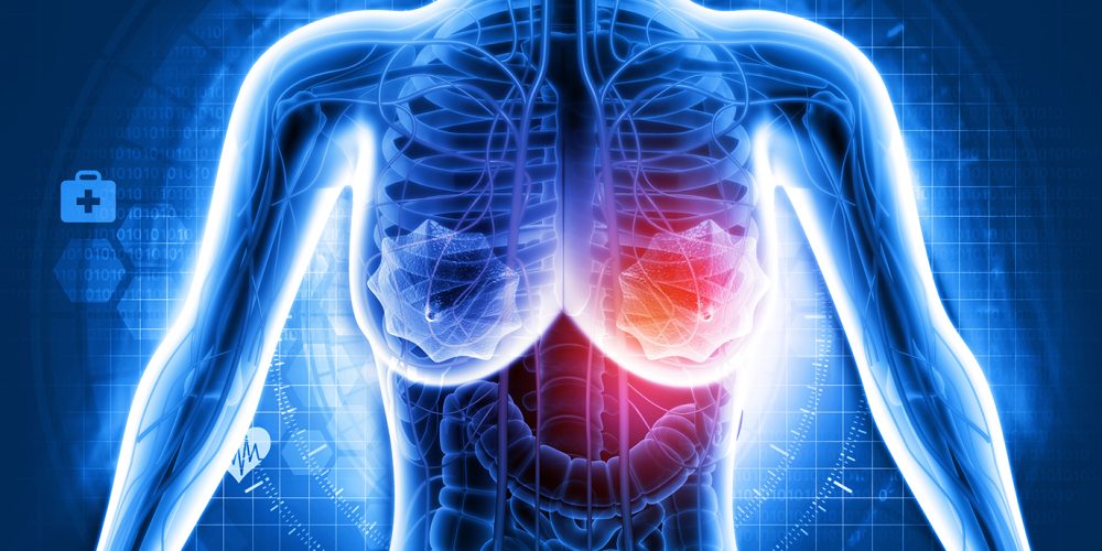 Low-Dose Hot Flash Treatment Shows Promise in Slowing ER-Positive Breast Cancer Growth