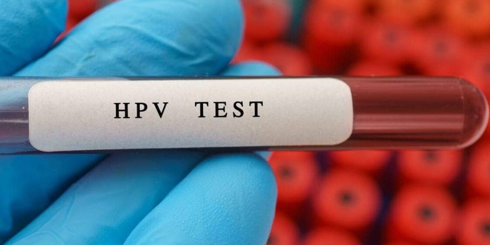 Menstrual Blood Test Shows Promise as Easier HPV Screening Method