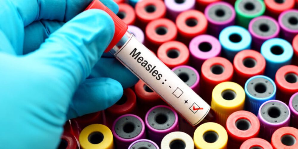 Mexico reports at least 28 measles deaths as nationwide outbreak continues