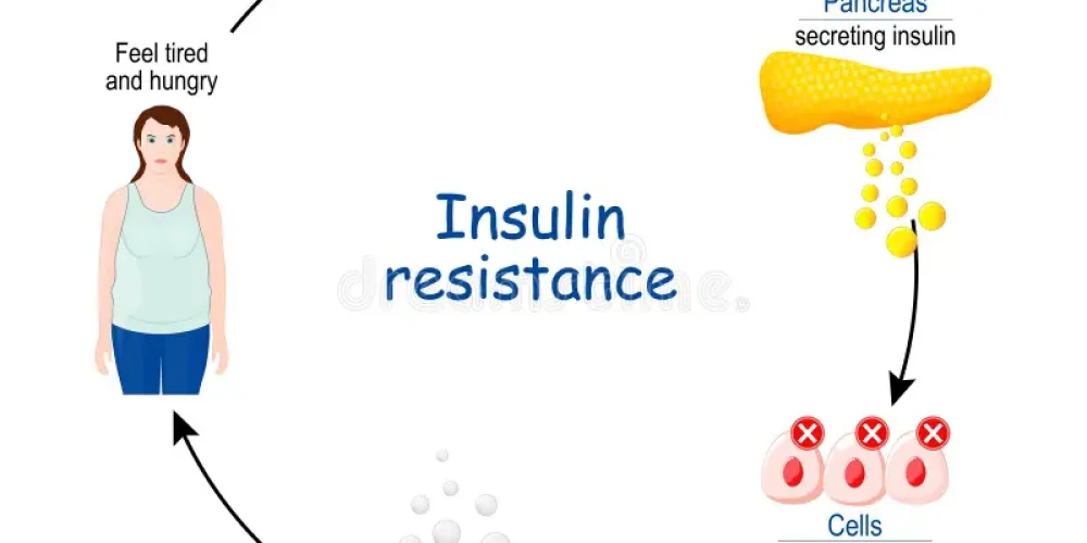 New Breakthrough: Gut Molecule TMA Identified as Surprising Ally in Reducing Insulin Resistance