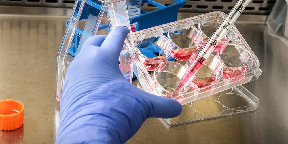 Rare Mpox Strain Detected in California with No Travel Link — Officials Stay Vigilant