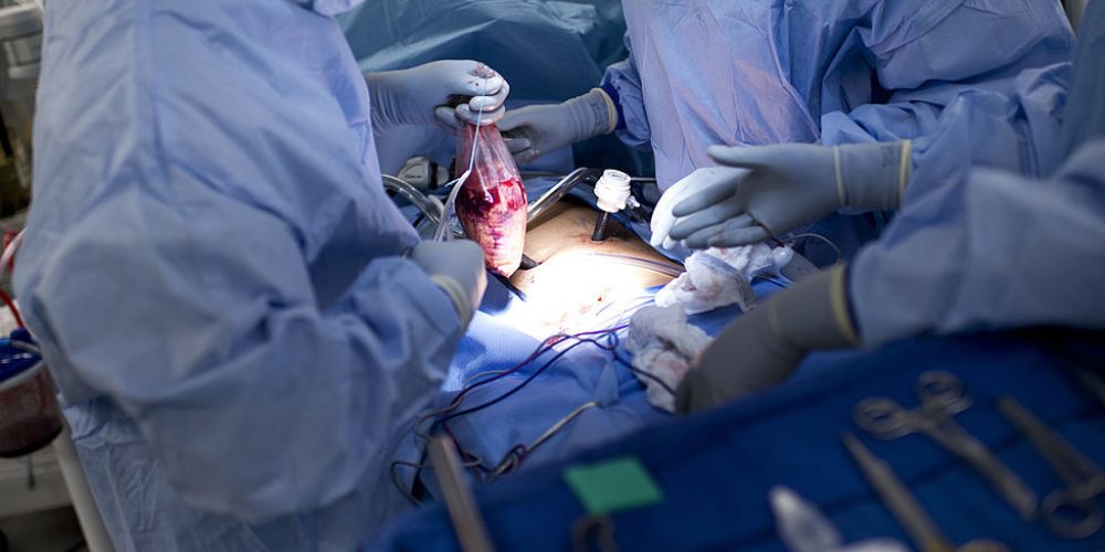 Record Survival After Pig Kidney Transplant Marks Major Milestone