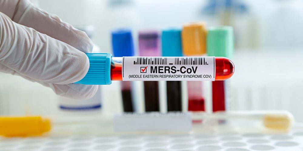 WHO adds MERS-CoV isolate to its BioHub System to enable rapid, transparent sharing of biological materials for pandemic research.