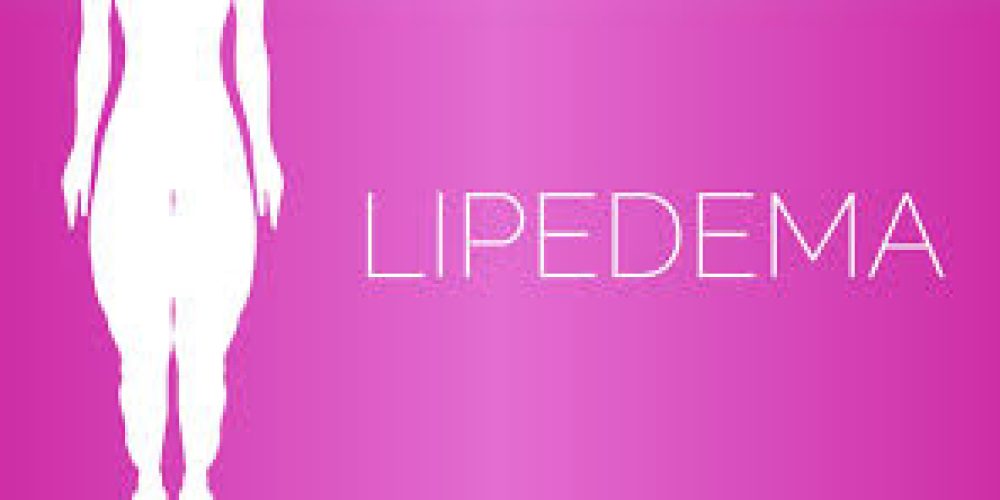 Medical Breakthrough: Lipedema Officially Recognized as a Chronic Disease